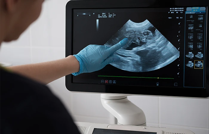 a hand pointing at a sonogram